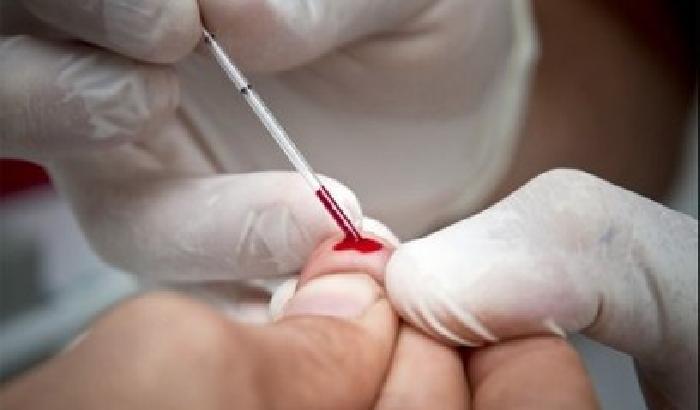 Usa, presto in commercio il test casalingo sull'Hiv