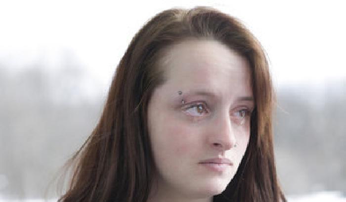 00CD3B-NEWS_103934 Donne vittime di violenza, una fotografa ritrae la loro voglia di vivere