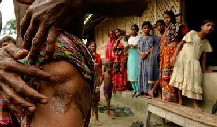 00E0EF-NEWS_115306 India: 84enne muore in ospedale dopo una violenza sessuale