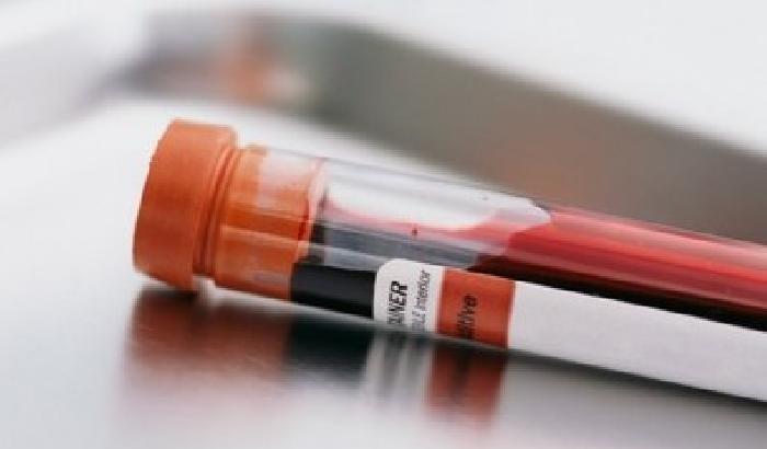 Tumori: addio alle biopsie, basterà un prelievo di sangue