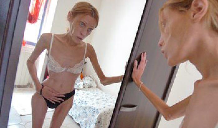 Una legge per combattere l'anoressia