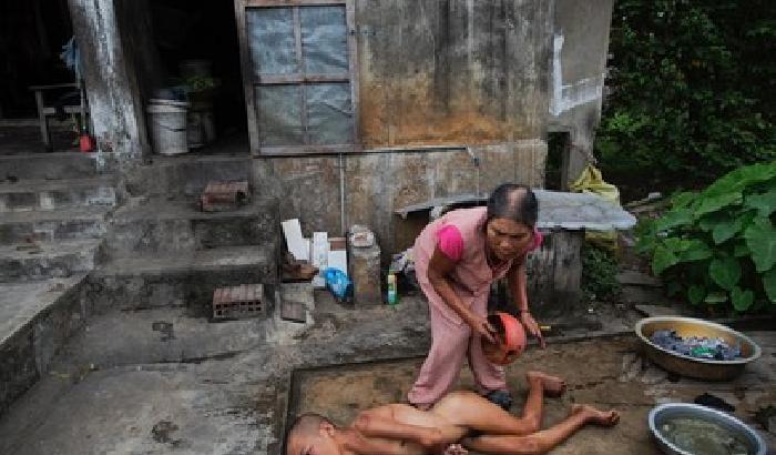 Agent Orange: l'eredità americana sul Vietnam