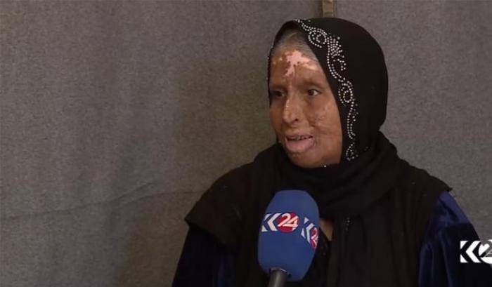 0342A2-muntaha-la-donna-ferita-dall-isis Muntaha, la donna ferita dall'Isis