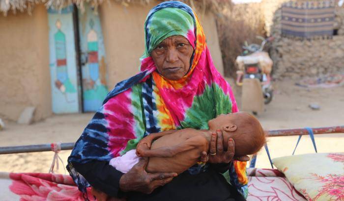 Madre e figlio soffrono la fame nello Yemen
