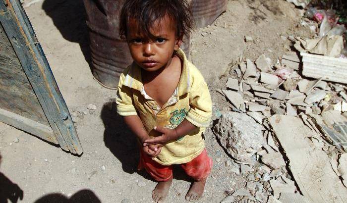 035261-sempre-piu-bambini-vittime-della-guerra-nello-yemen Sempre più bambini vittime della guerra nello Yemen
