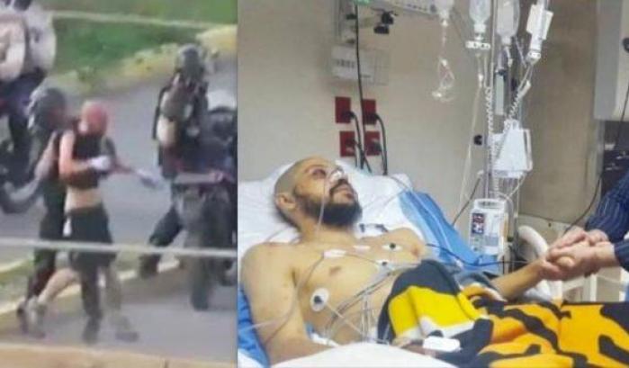 Venezuela, ragazzo di origini abruzzesi brutalmente picchiato dalla polizia