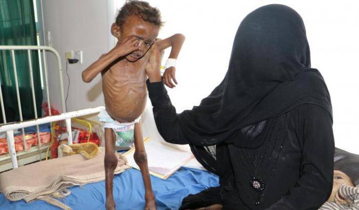 Oltre mezzo milione di bambini soffrono la fame in Yemen