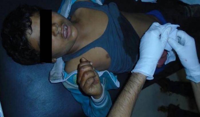 0004CA28-il-bambino-ucciso-dai-turchi-nel-rojava Il bambino ucciso dai turchi nel Rojava