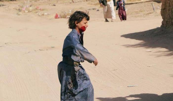Un ragazzino ferito in un bombardamento nello Yamen