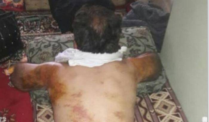 0004E390-un-curdo-torturato-dalle-bande-jihadiste-filo-turche-ad-afrin Un curdo torturato dalle bande jihadiste filo-turche ad Afrin