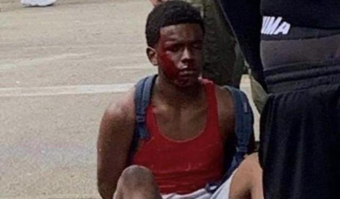 000528DE-il-ragazzo-arrestato-e-picchiato-in-florida Il ragazzo arrestato e picchiato in Florida