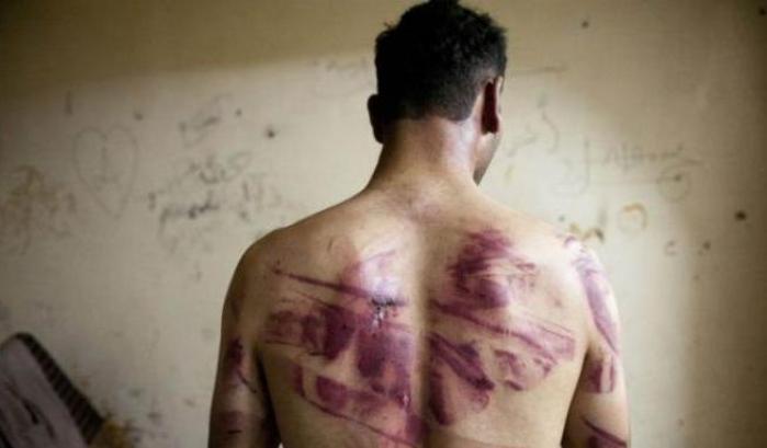 00054485-un-oppositore-di-assad-mostra-i-segni-delle-torture Un oppositore di Assad mostra i segni delle torture