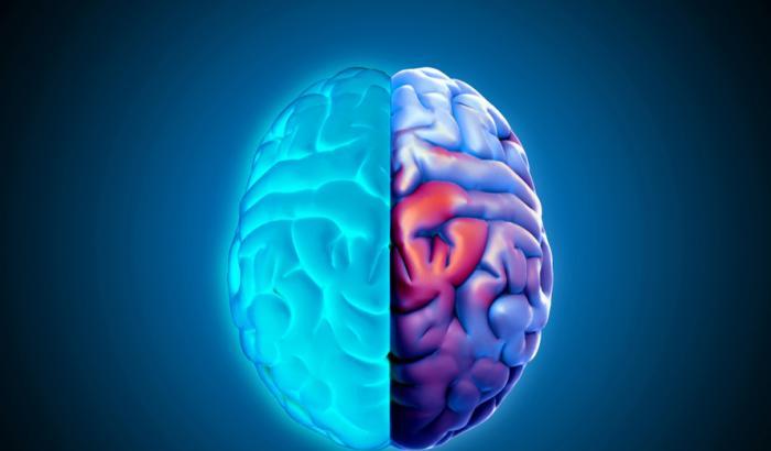 E' nata con metà cervello ma è più intelligente della media