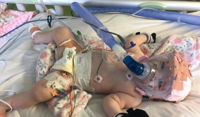 Si infetta di Covid-19 in ospedale dopo un'operazione al cuore: il calvario di una bimba di 6 mesi