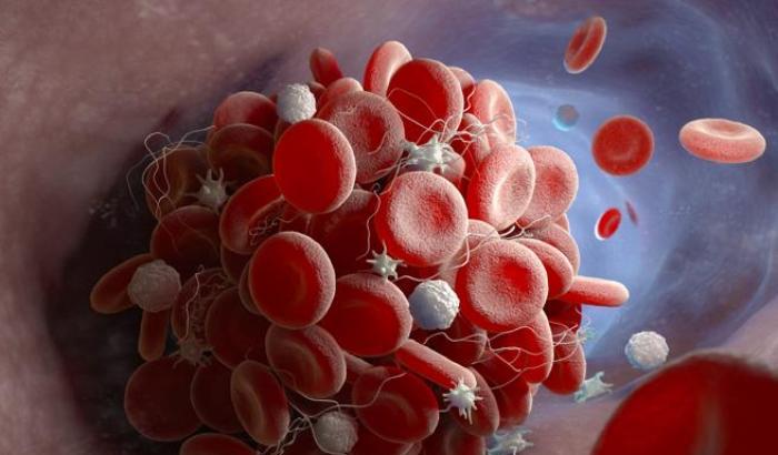 Facciamo chiarezza. E' vero che il Covid è clinicamente morto?