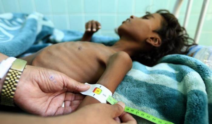 Yemen, l'apocalisse lontana dagli occhi del mondo