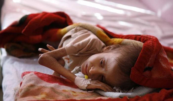 Le sofferenze dei bambini nello Yemen