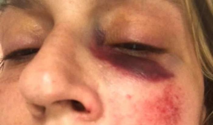 0005C26F-beatrice-lucrezia-orlando-la-donna-picchiata Beatrice Lucrezia Orlando, la donna picchiata