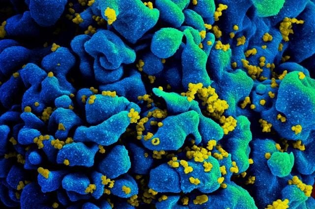 La 'nuova variante' Hiv in realtà è conosciuta da trent'anni: ecco perché se ne riparla