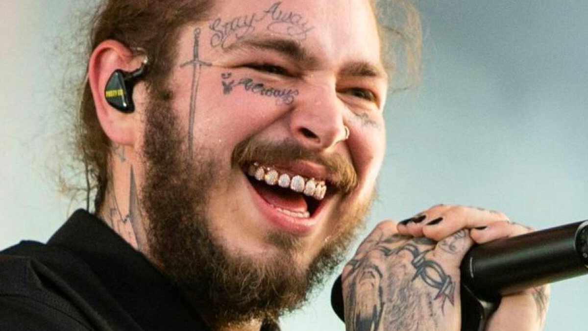 "Come ho reimpiantato un dente da un milione di dollari" - Il dentista italiano chiamato in soccorso da Post Malone