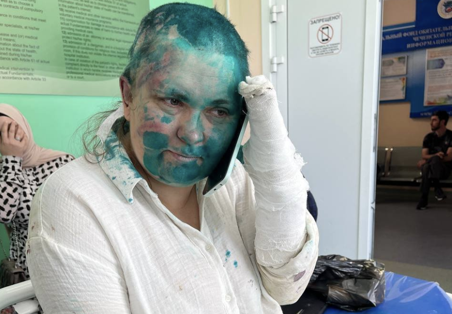 Elena Milashina picchiata e rasata mentre indagava sulle persecuzioni gay in Cecenia