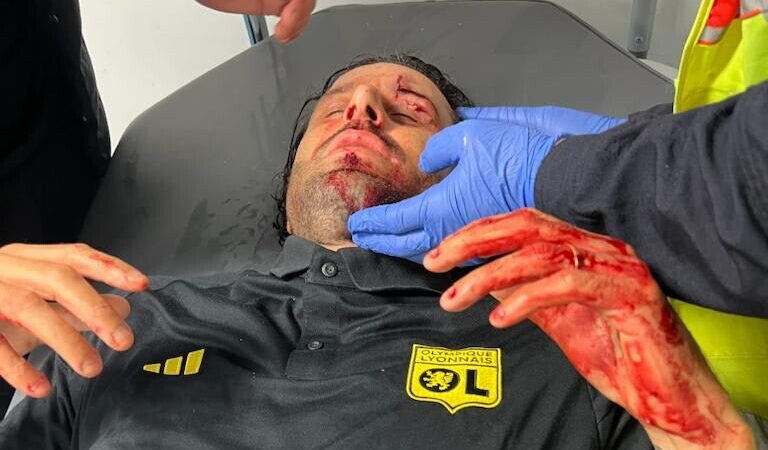 Sassate degli ultras del Marsiglia contro il pullman del Lione: ferito Fabio Grosso