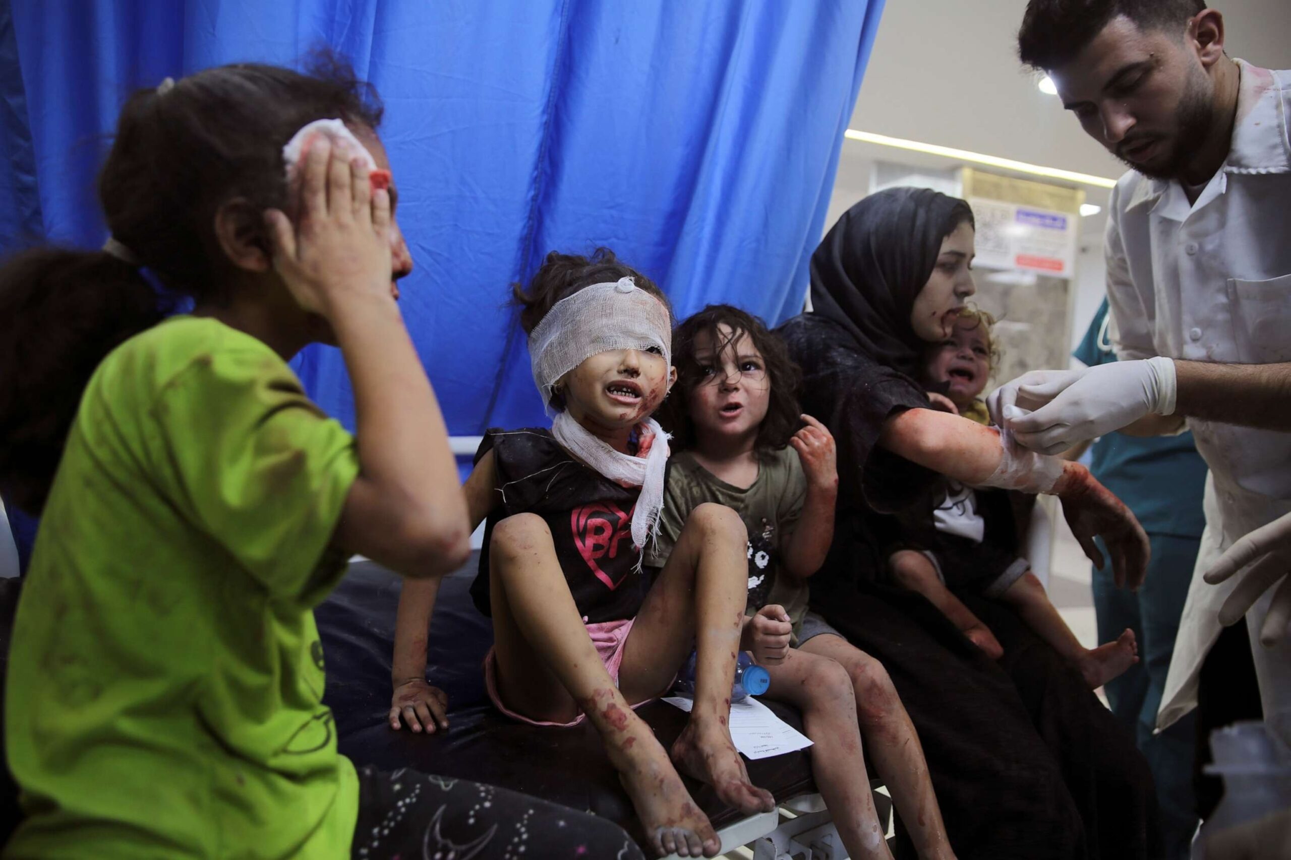 L'orribile testimonianza da un ospedale di Gaza: "Lasciati morire i pazienti che hanno bisogno di un ventilatore"