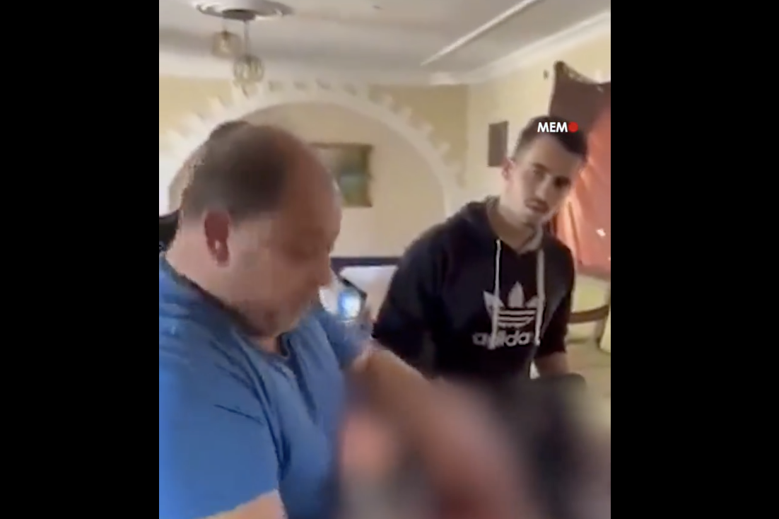 Gaza: un medico costretto ad amputare la gamba della figlia ferita senza anestesia